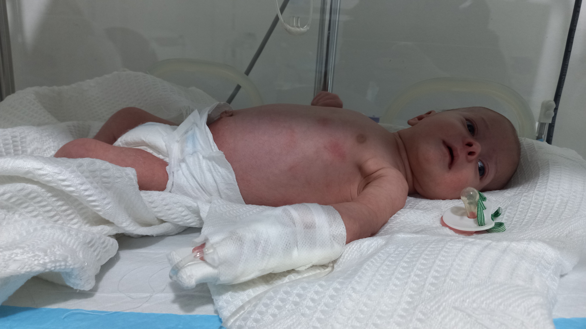 A newborn girl needs an incubator.