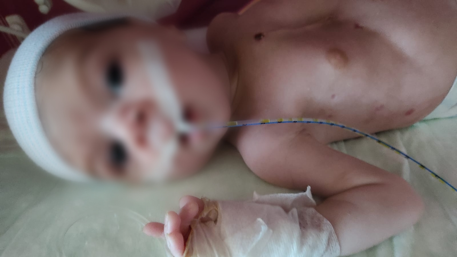 Baraa suffers from congenital heart disease and needs urgent surgery