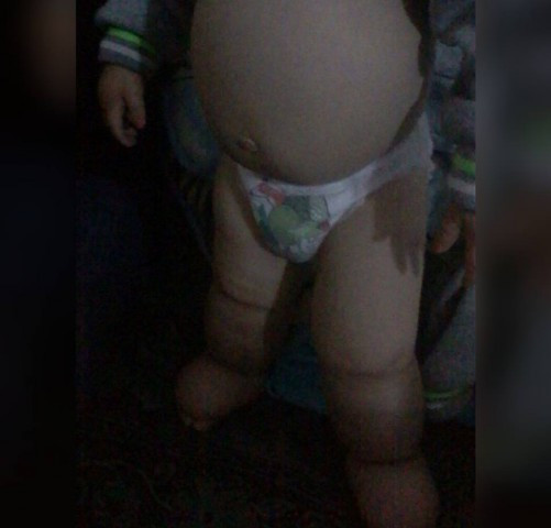 Medical Assistance for a child