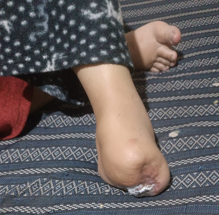 A disease consuming her body, and life growing harder