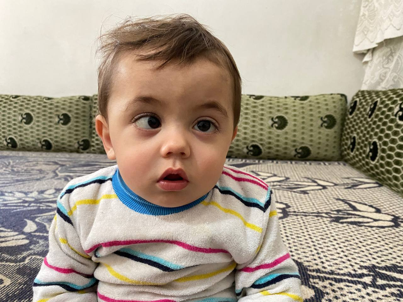 An infant who suffers from exotropia