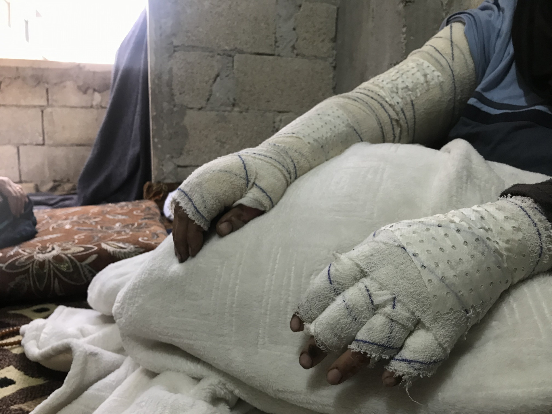 A mother and her son, are victims of bombing