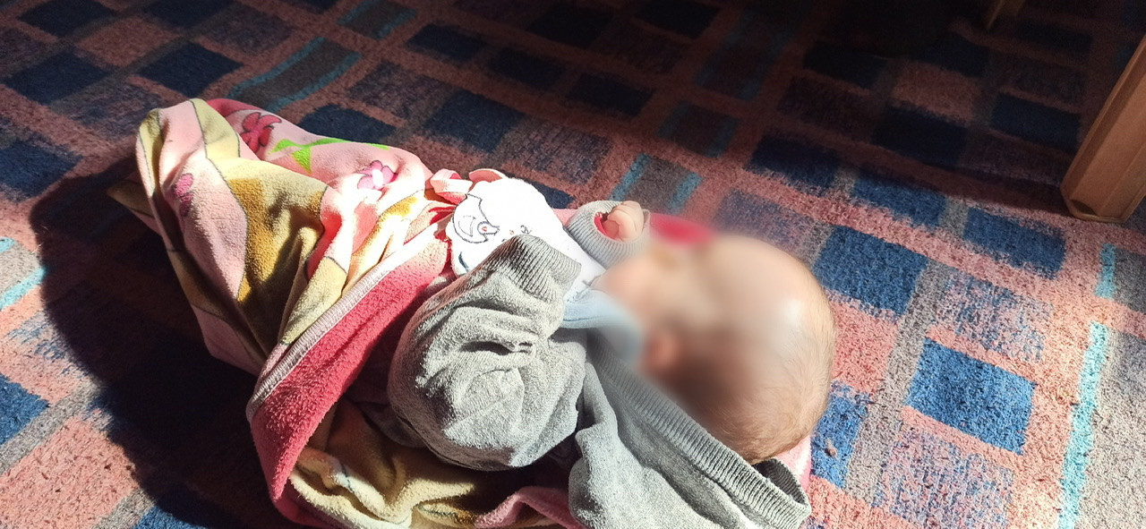 A newborn with hydrocephalus needs cerebral shunt urgently.