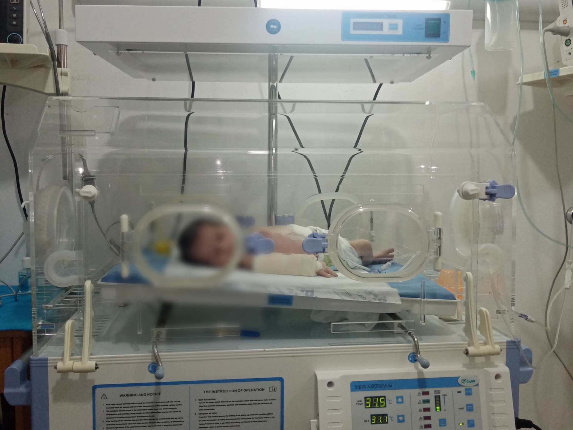 A little girls suffers from severe inflammations