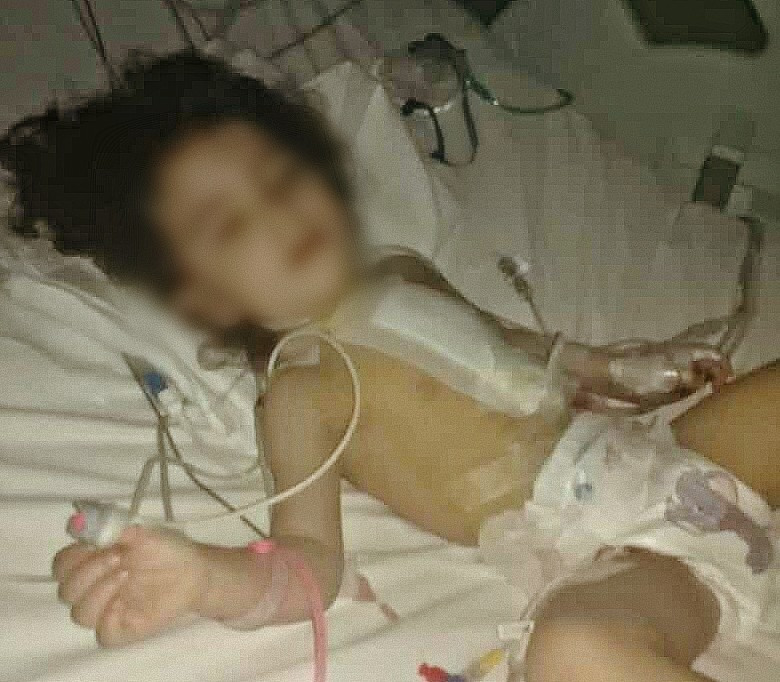 A girl was born with a cardiac defect and other problems
