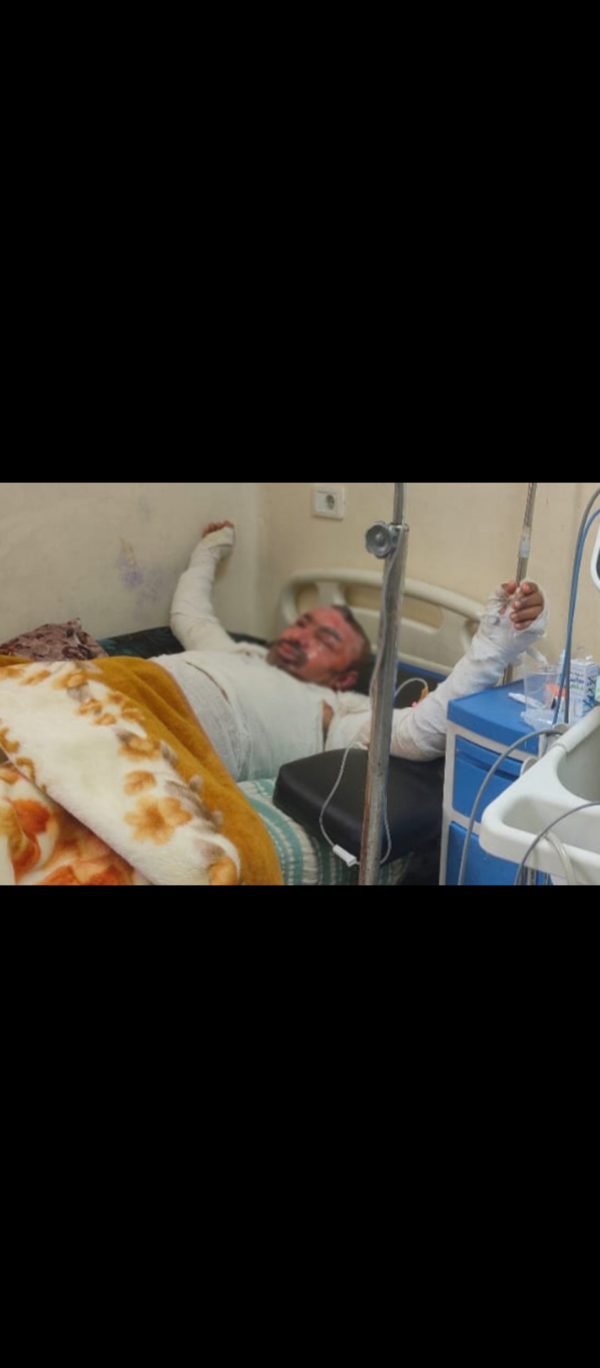 محمد… حروق شديدة غيّرت مجرى حياته