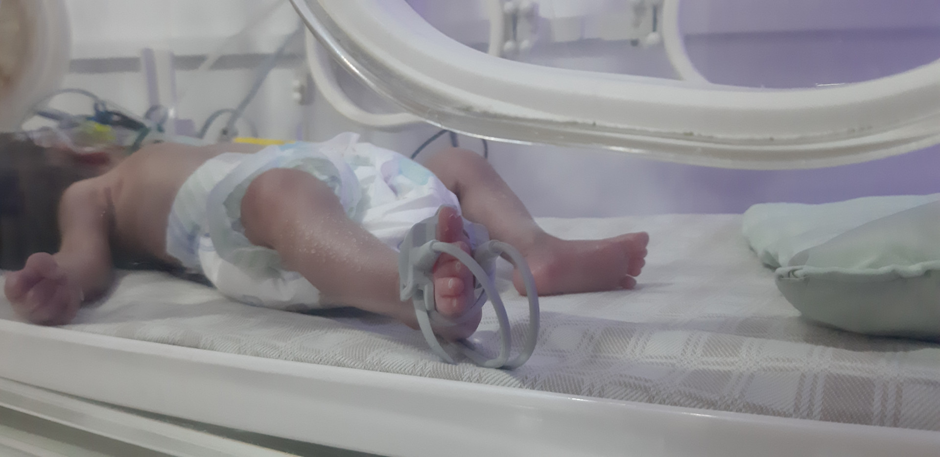 a newborn needs hospitalization
