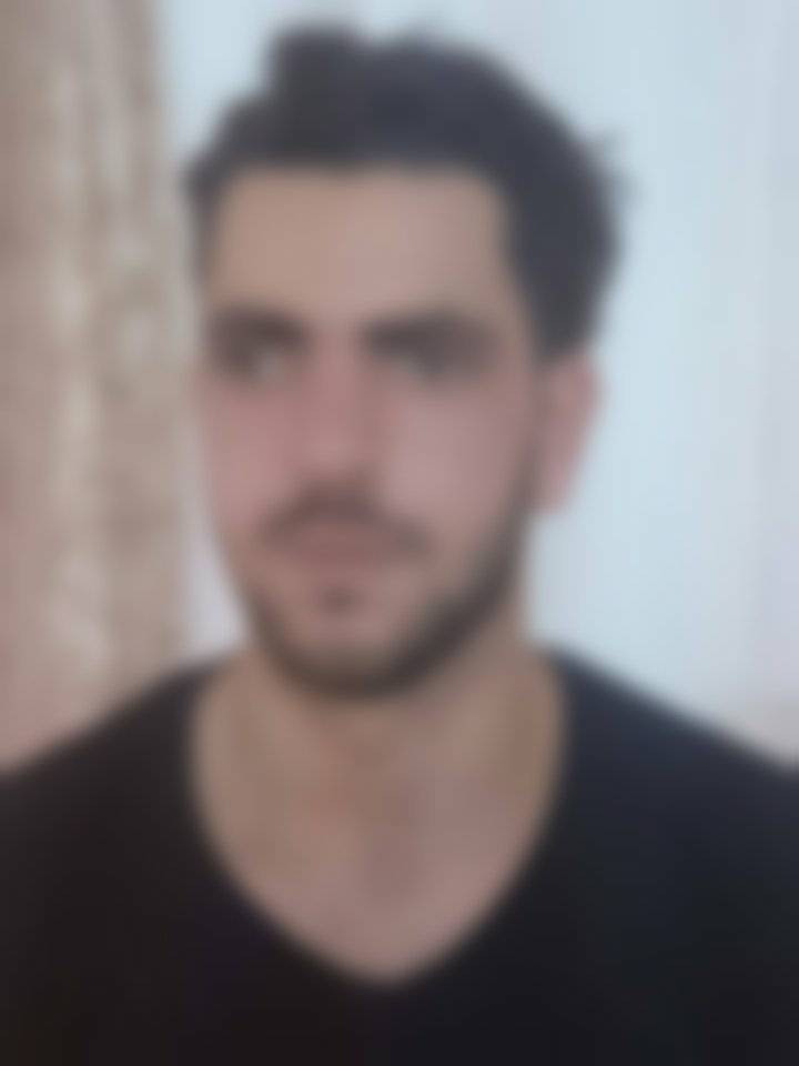 A young man in need for an eye surgery