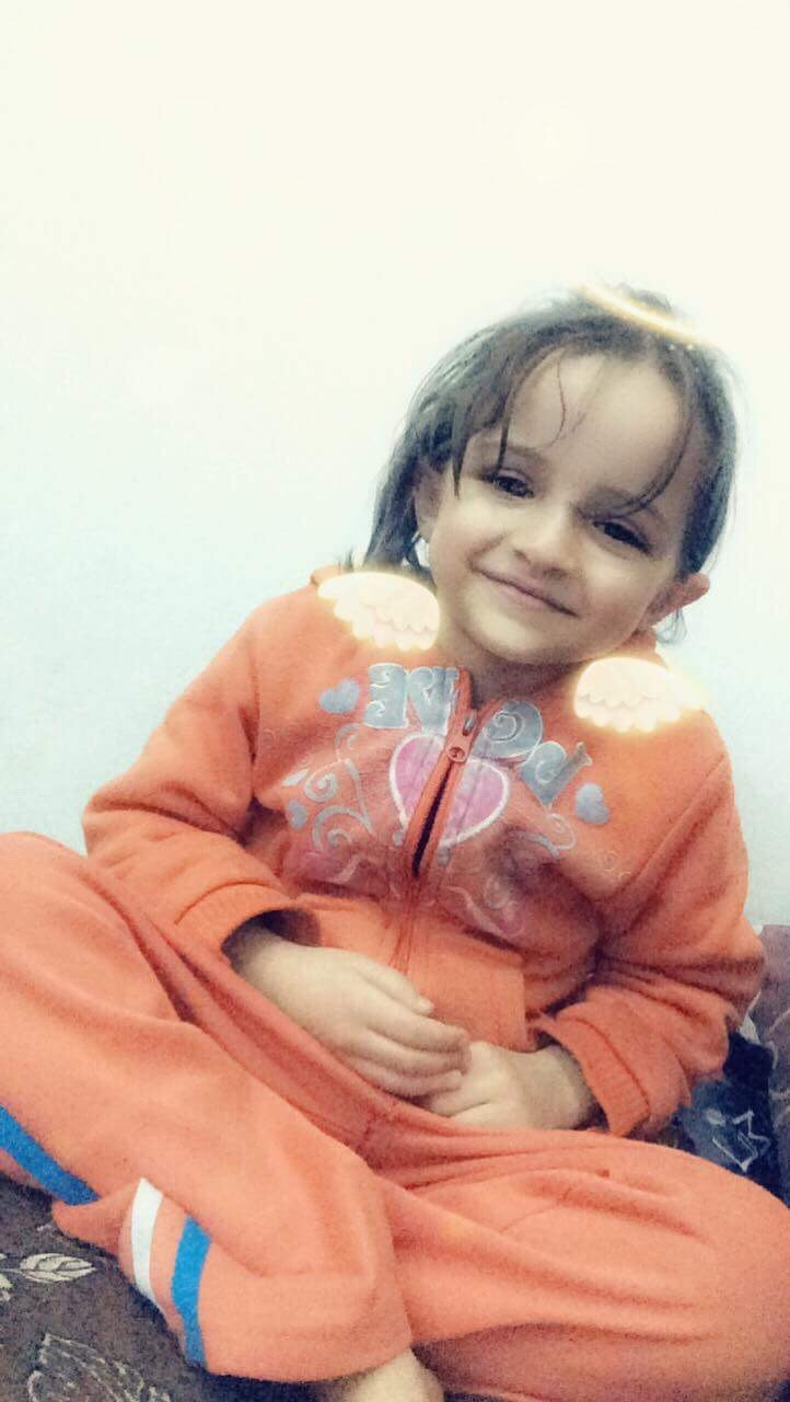 Tonsillectomy is needed for a child