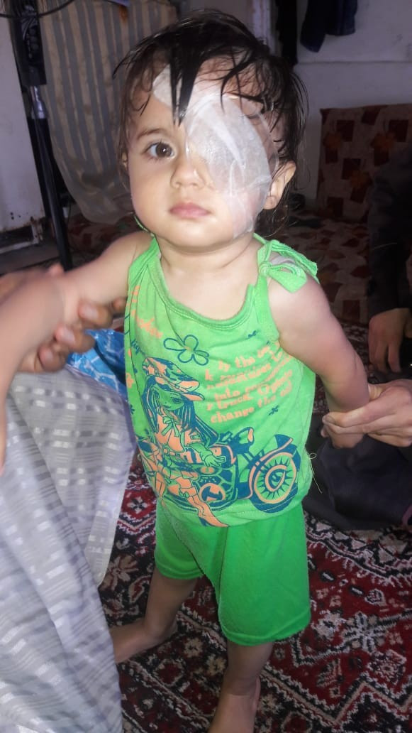 Urgent stitches removal for a toddler
