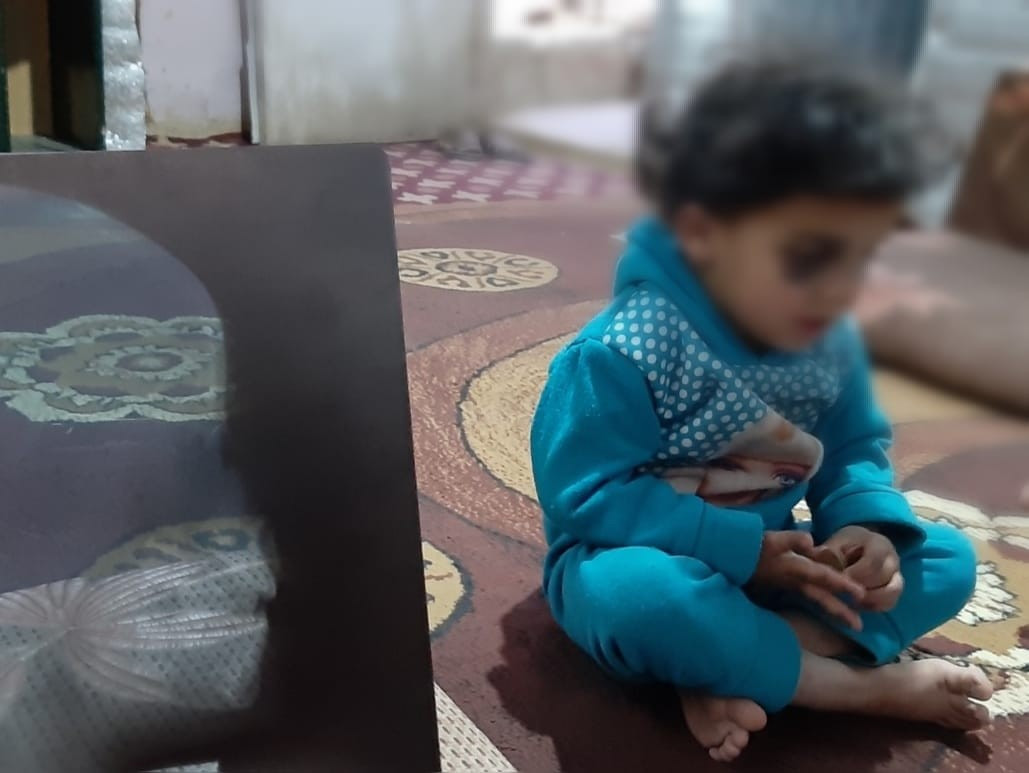 A little girl in need for surgery