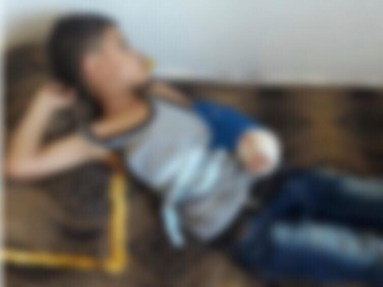 Child suffering from a broken elbow ligament