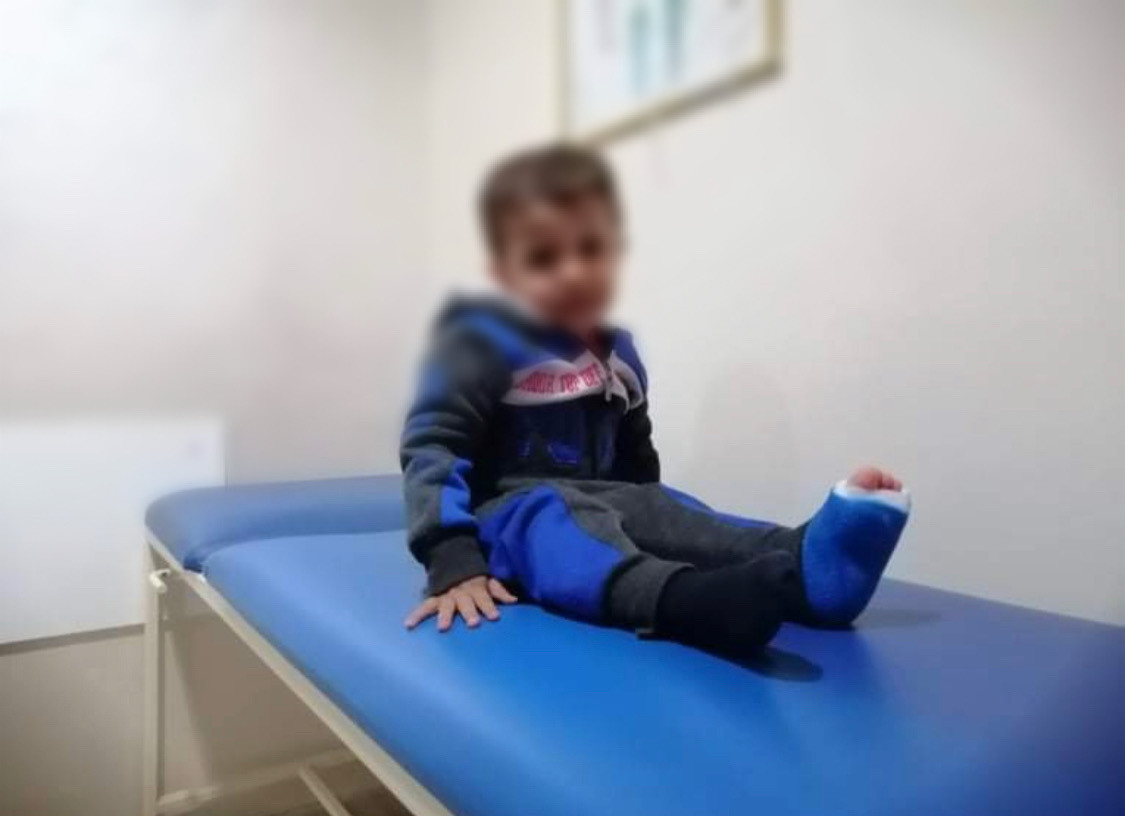 A little child is with a broken leg needs surgery