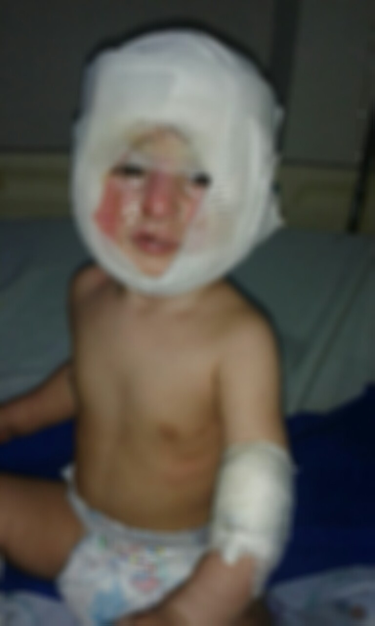A family needs treatment costs and living expenses