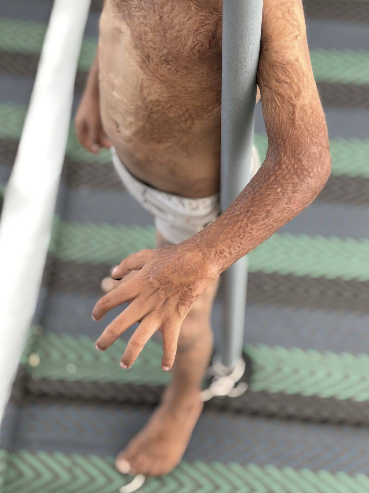 معين أصيب في القصف على غزة