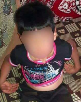 A child needs surgery