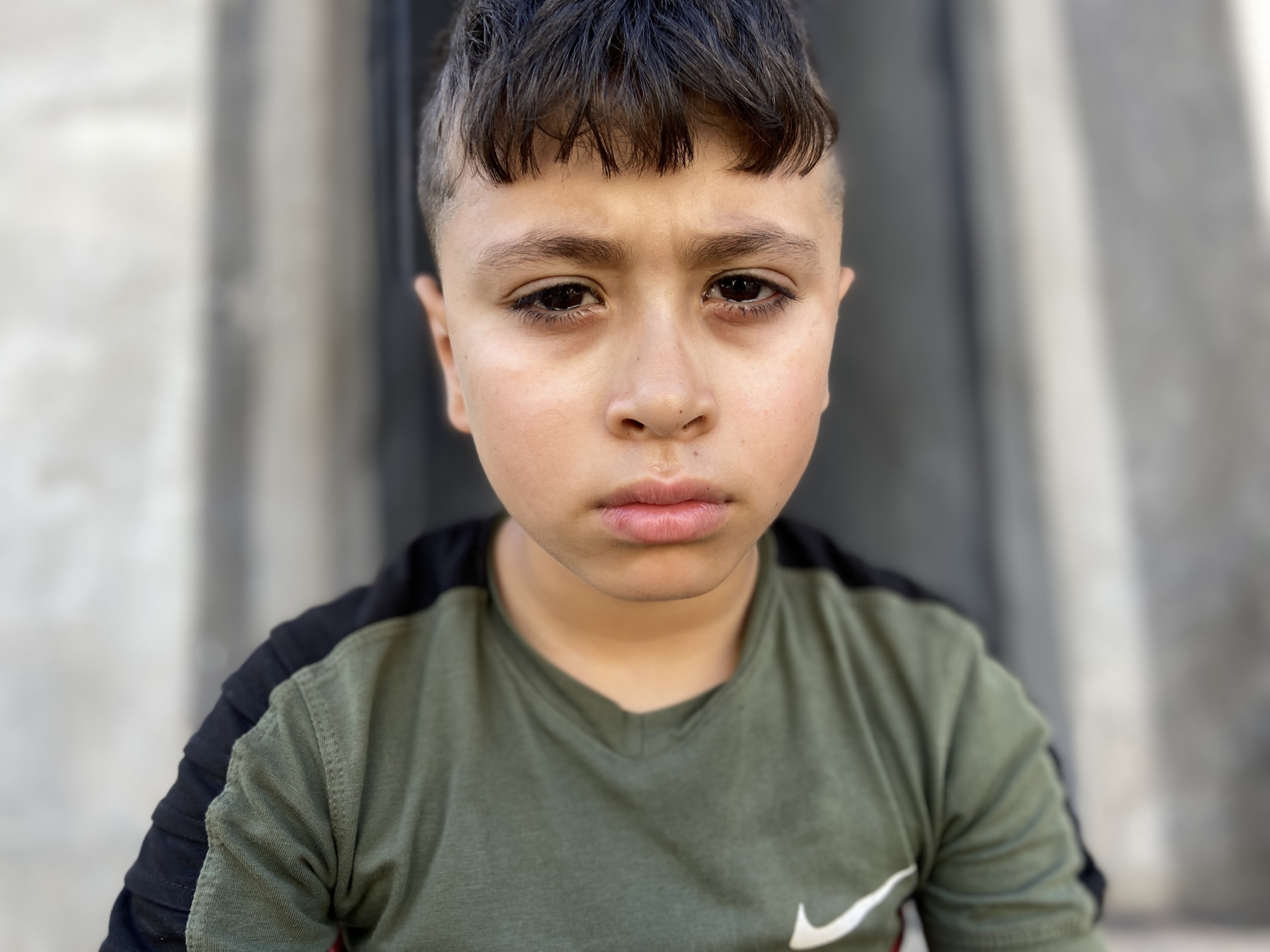 Majd endure severe pain in his eye and needs your help