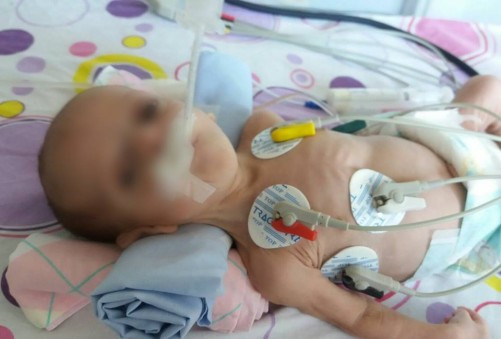 a kid with a heart disease