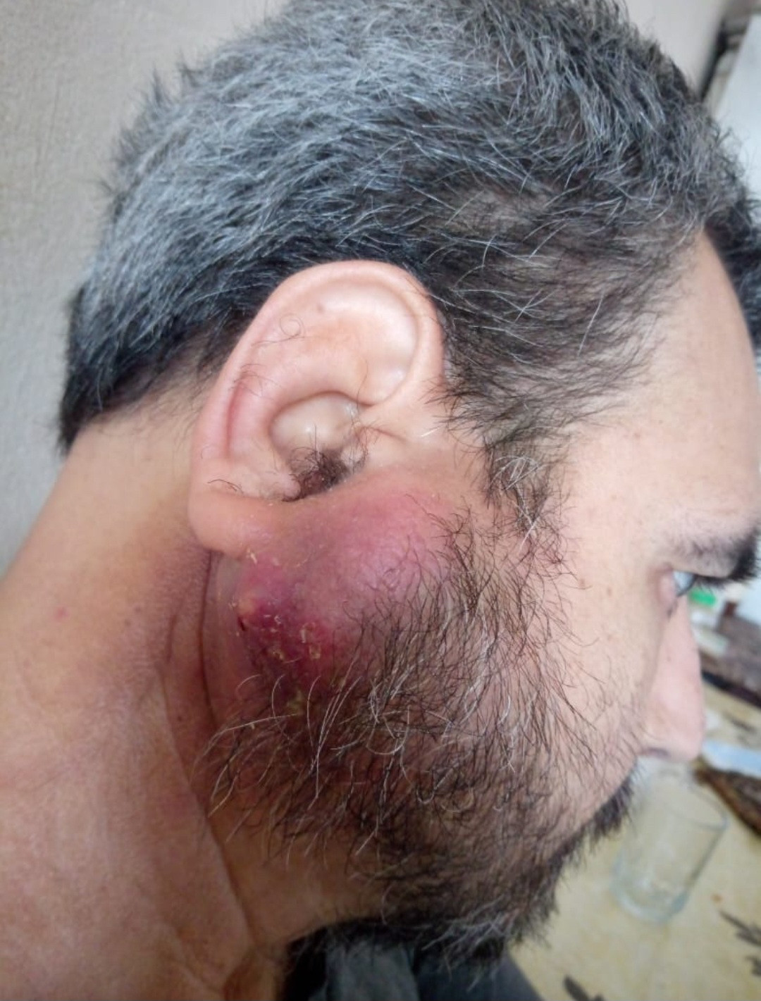 Ahmed has throat cancer and needs your help!
