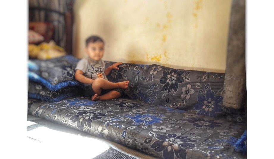 A child suffers from out-toeing