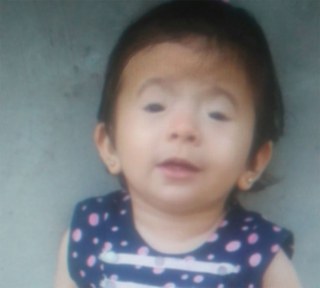 A girl child needs an operation for her eyes