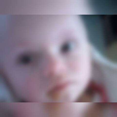 A child suffers from Hydrocephalus.