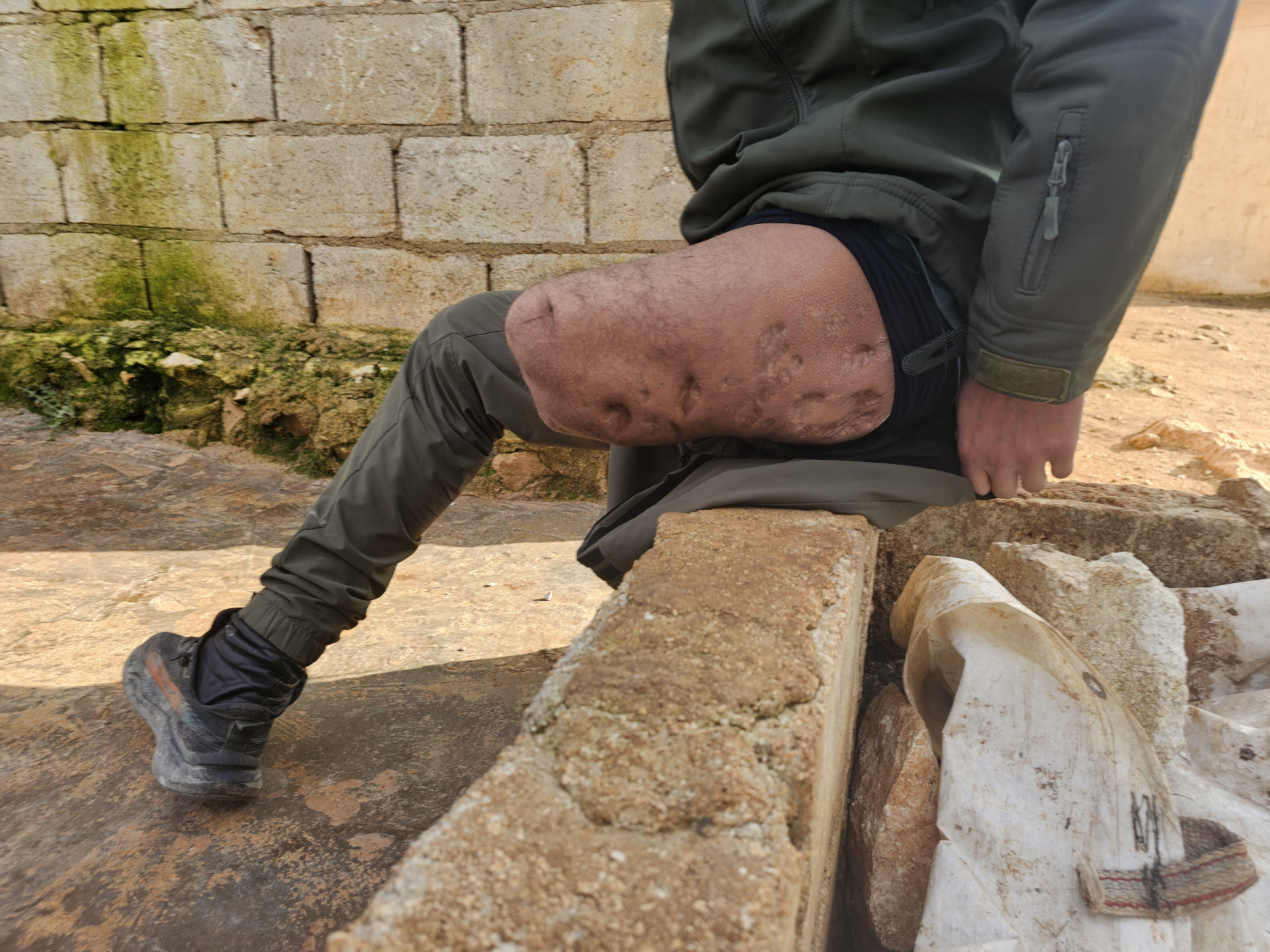 جراح لا تنتهي