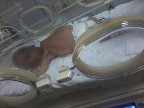 Treatment expenses for a child