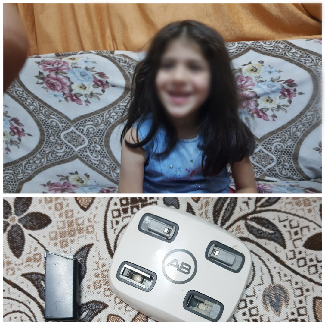 طفلة فقدت سمعها