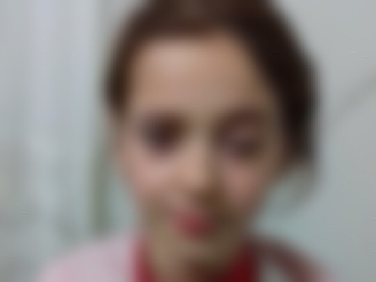 Child needing eye surgery