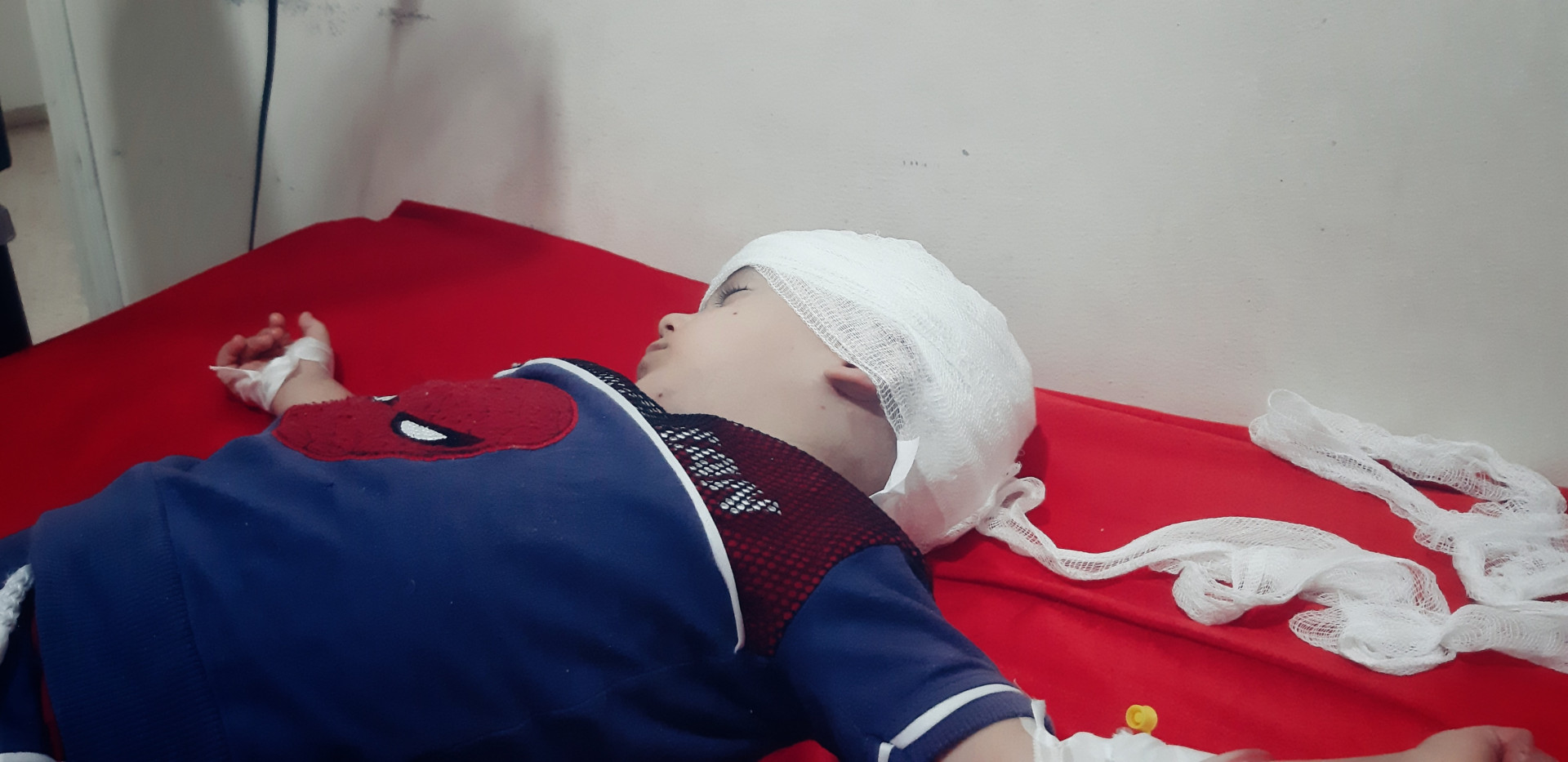 A child with hemophilia