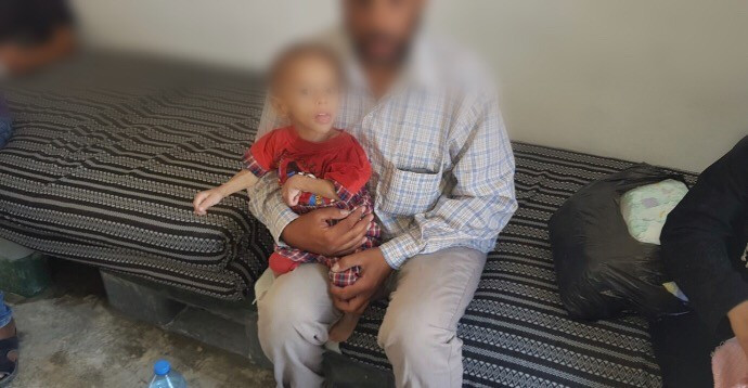 طفل يعاني من نقص في النمو وسوء تغذية
