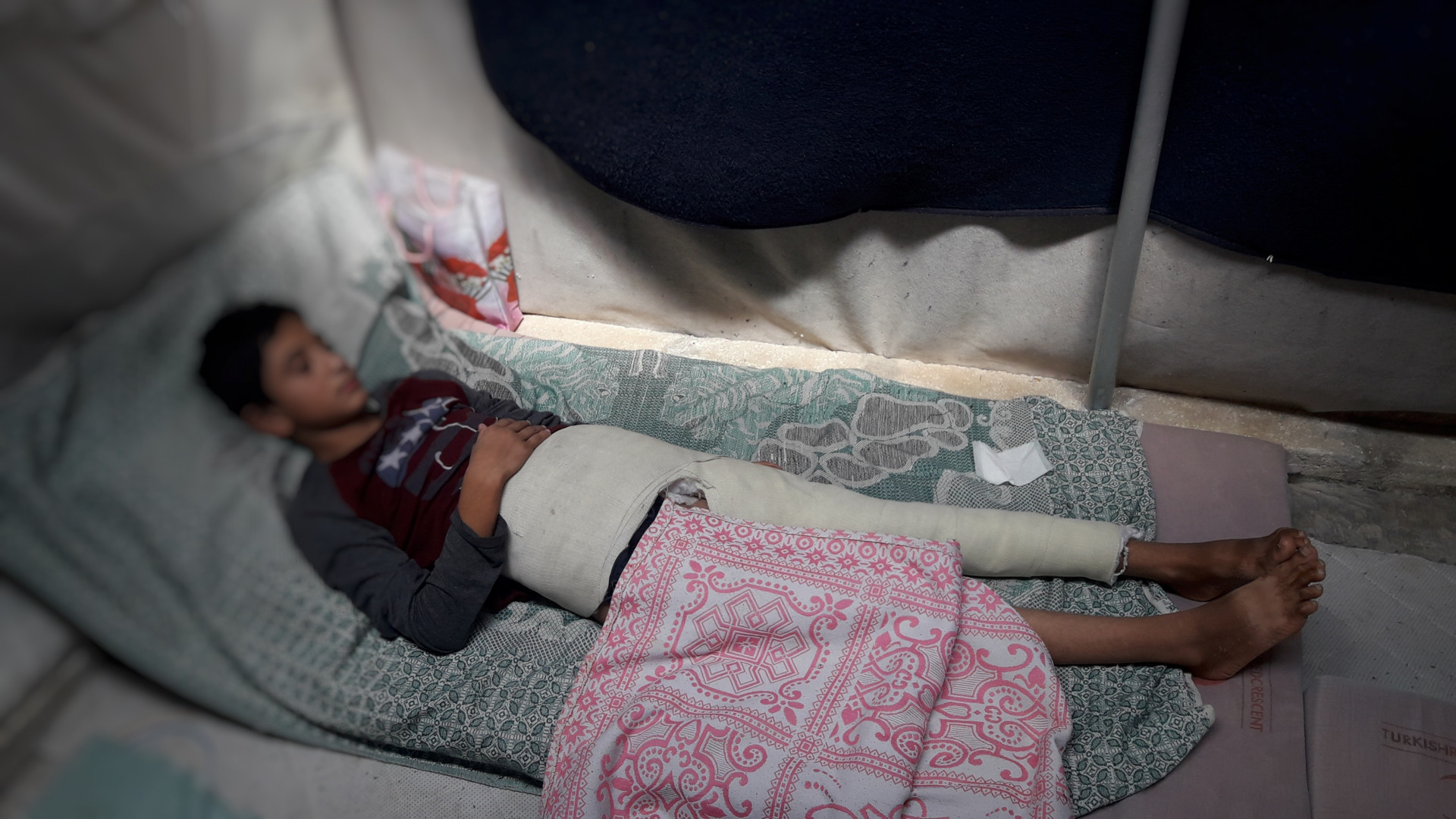 A child suffered a broken foot and lives in tragic circumstances!