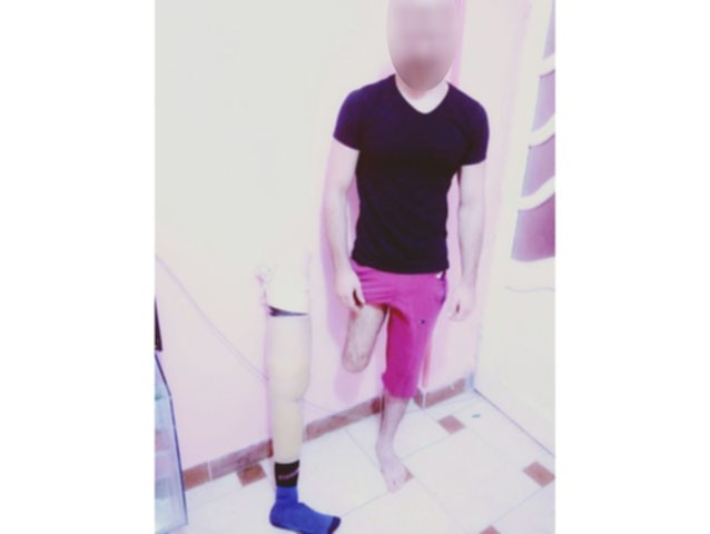 A Young Man with a Leg Amputation and a Renal Fatigue Needs Help