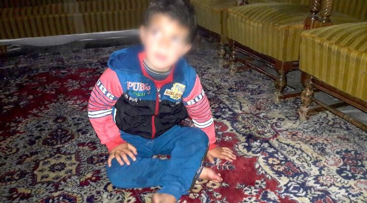 A little child with suffering