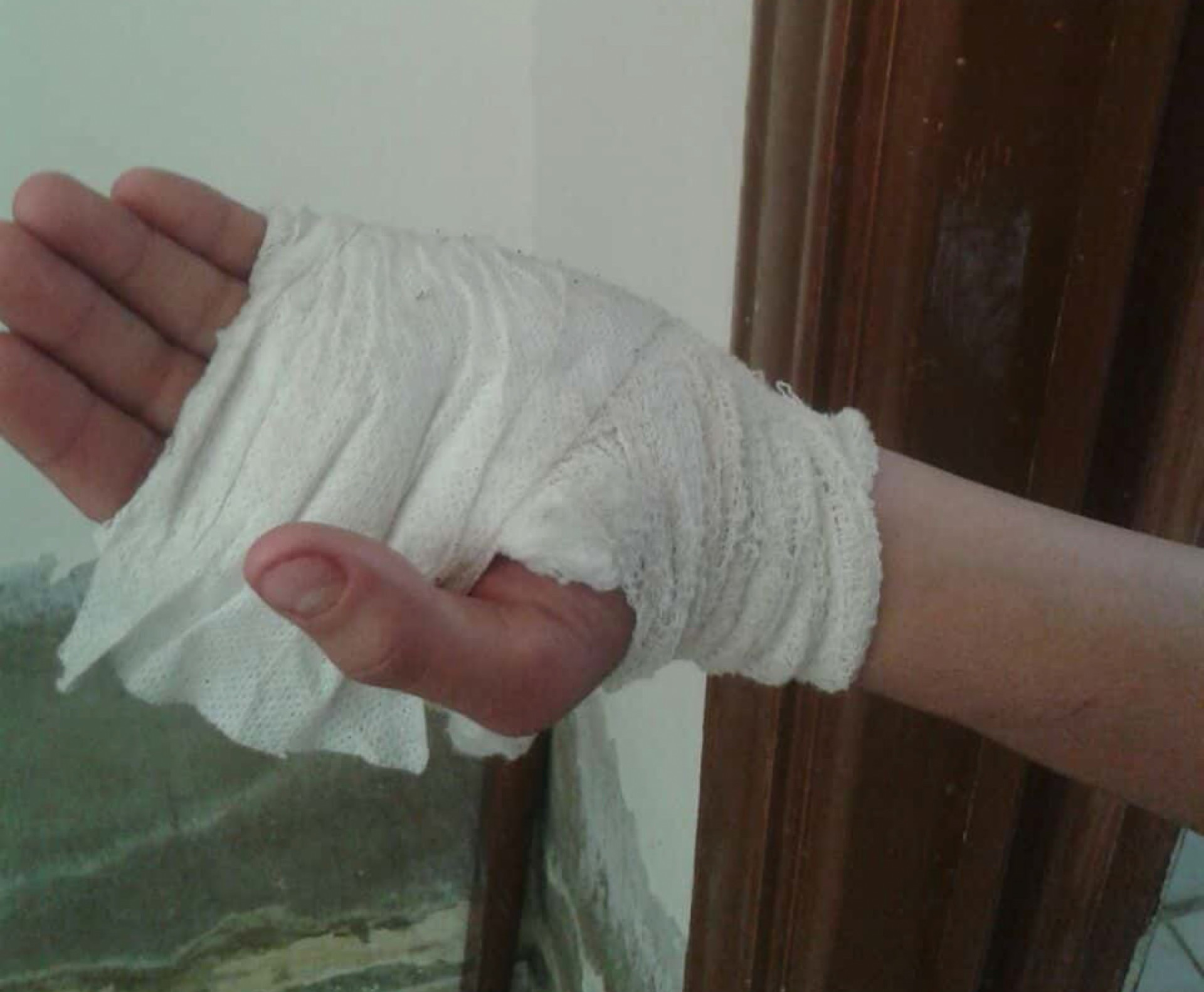 A kid needs an urgent operation for his hand