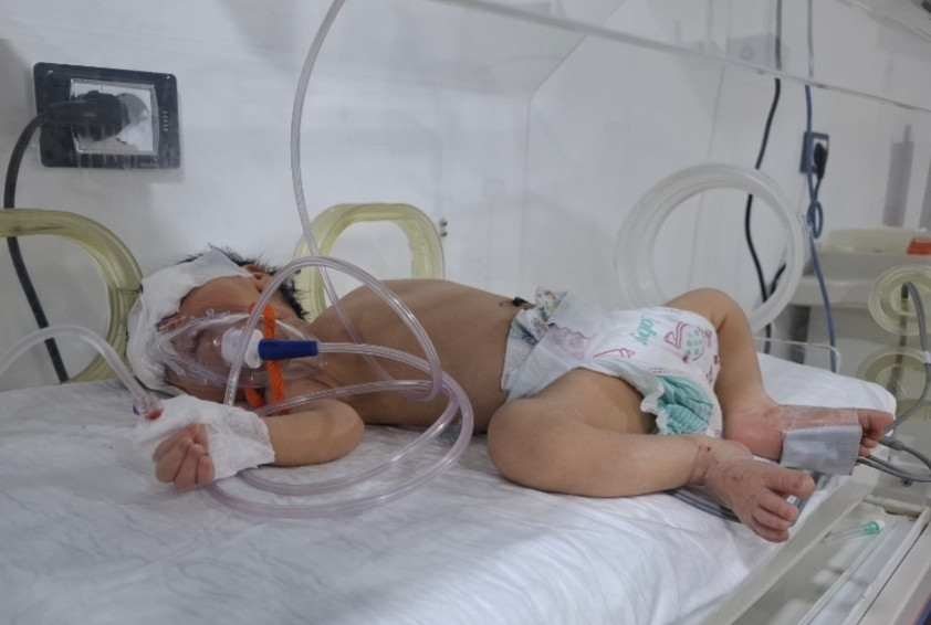 أحلام… بدأت حياتها على جهاز التنفس