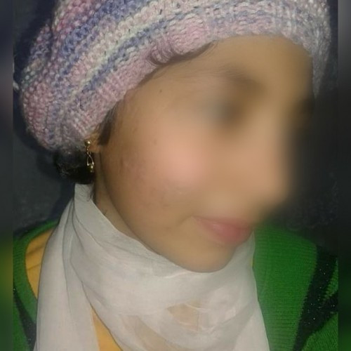 child in need for cornea implantation