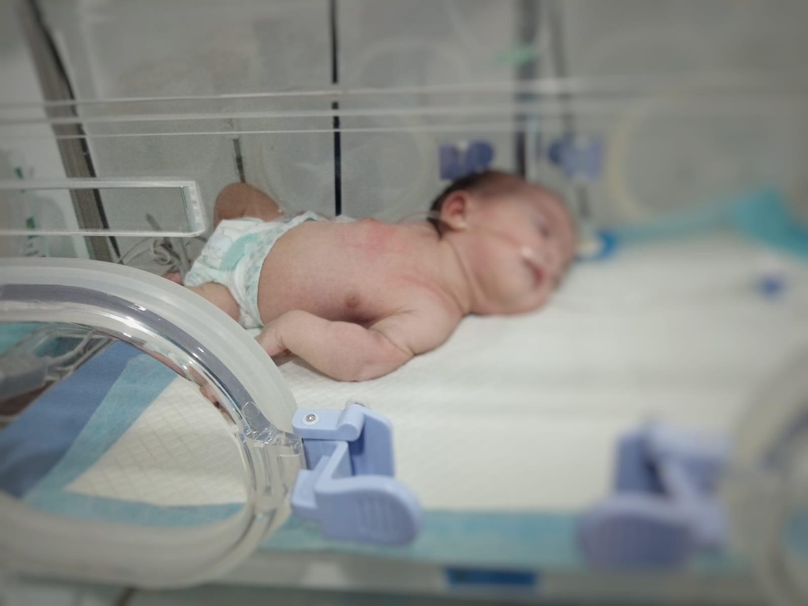 الطفلة ملاك تحتاج دعمكم