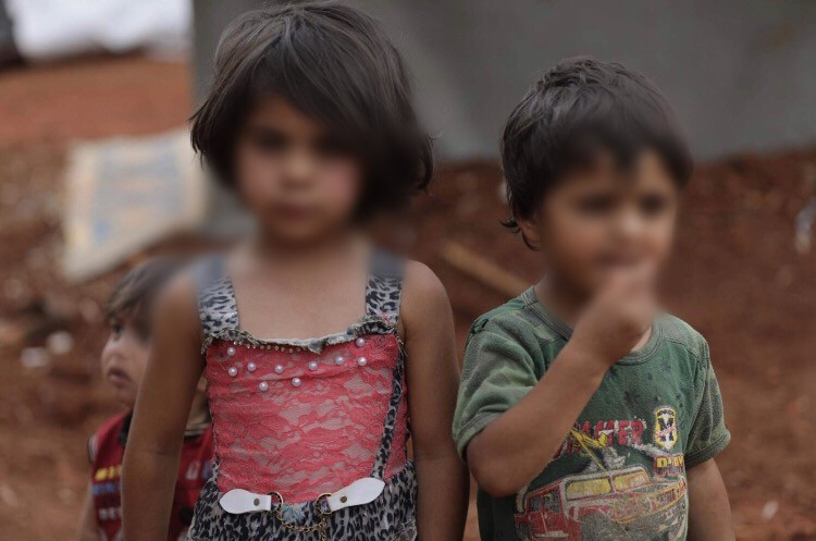 two children suffer from nystagmus, need lens surgery