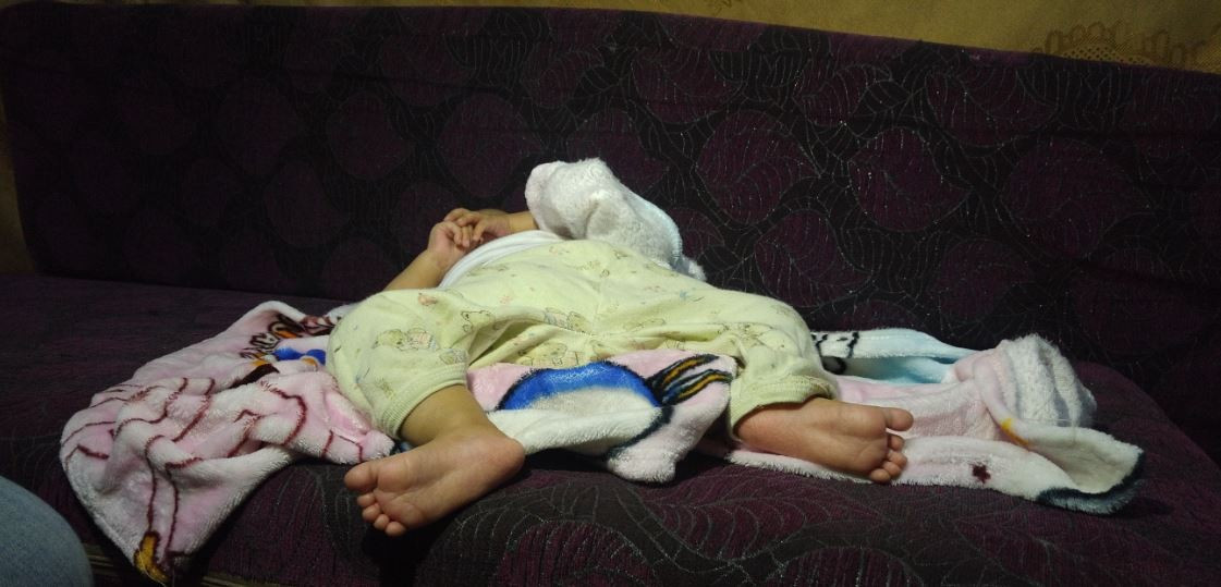 newborn with developmental hip dysplasia