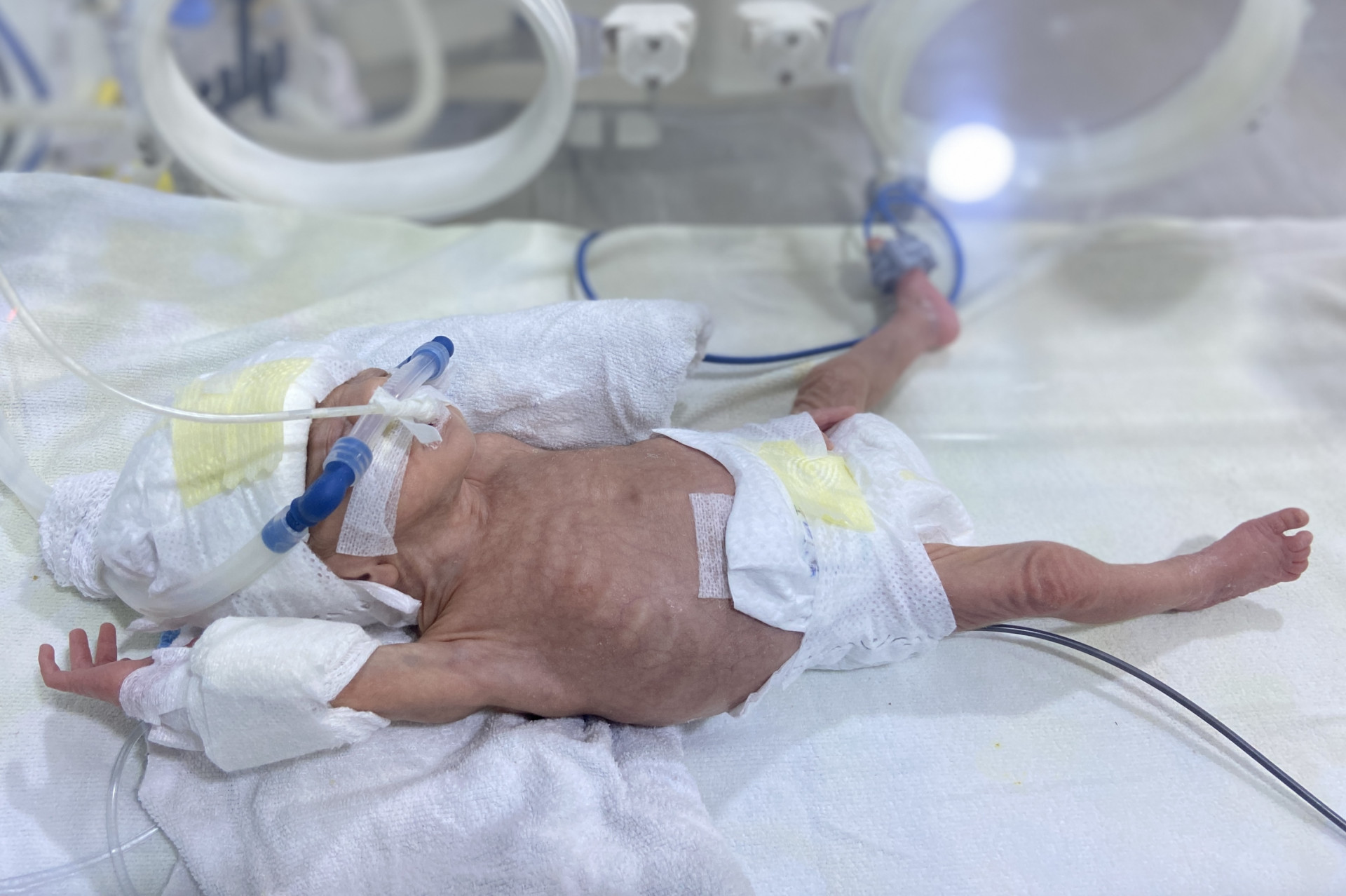 Baby Fatima is in need of your help