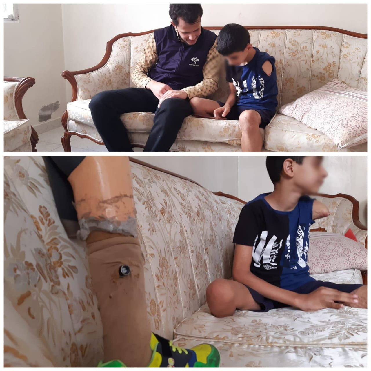 Mohammad is with amputated arm and leg needs surgery