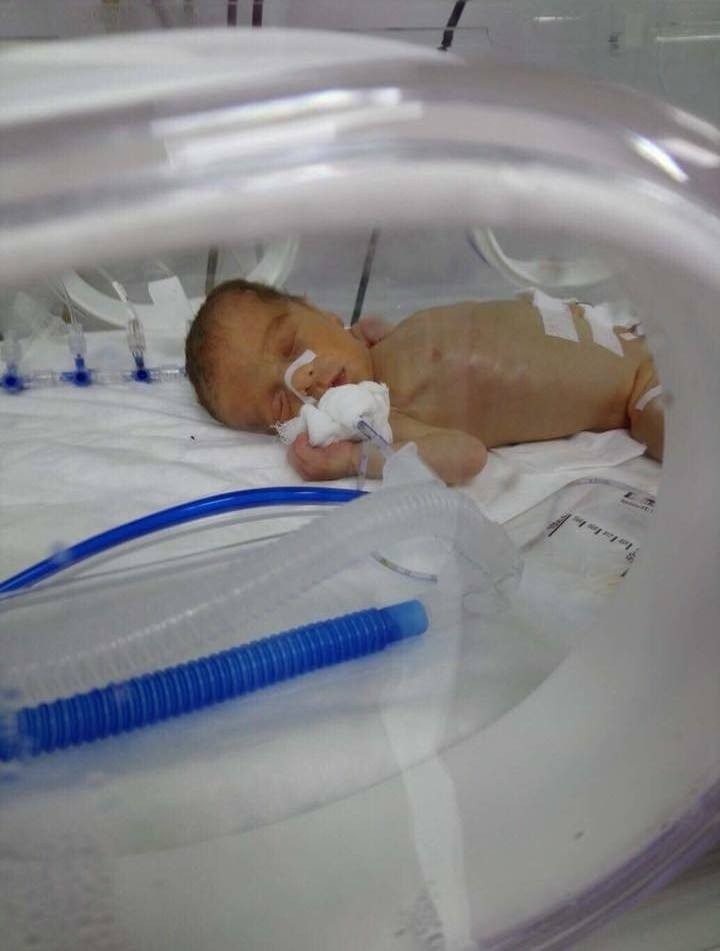 a baby needs NICU admission to survive