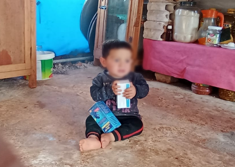 Radi needs medications for cerebral atrophy