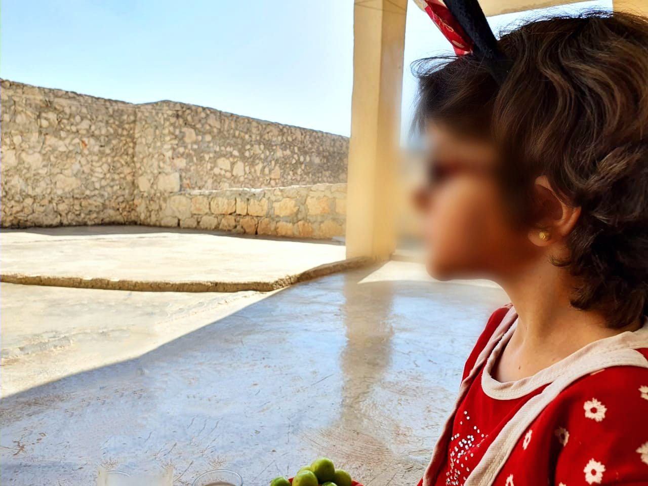 Mariam is with strabismus and needs treatment