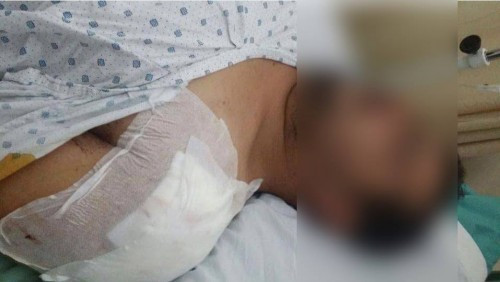Treatment expesnes for a male refugee