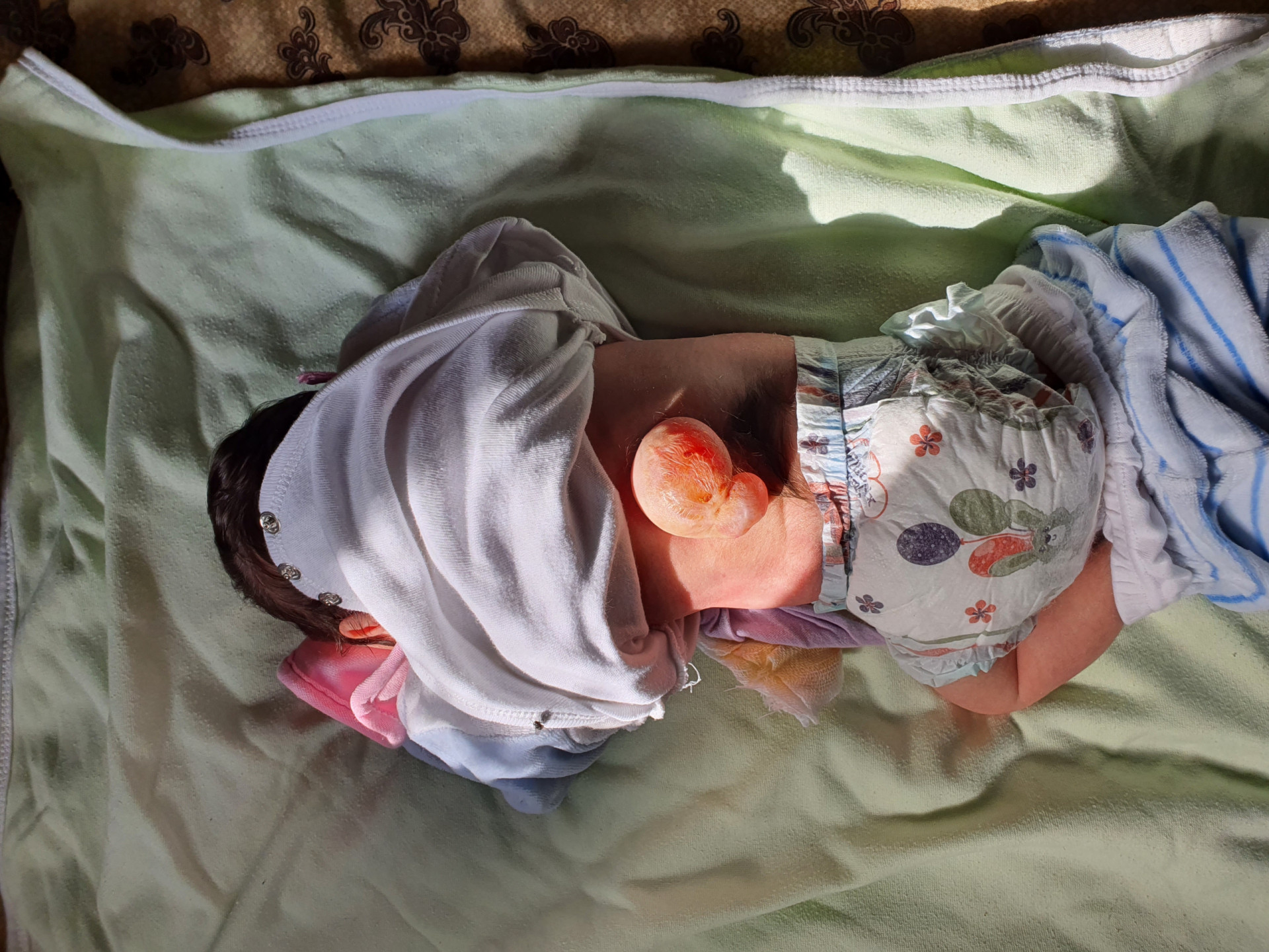 Basma needs an urgent treatment to avoid complications