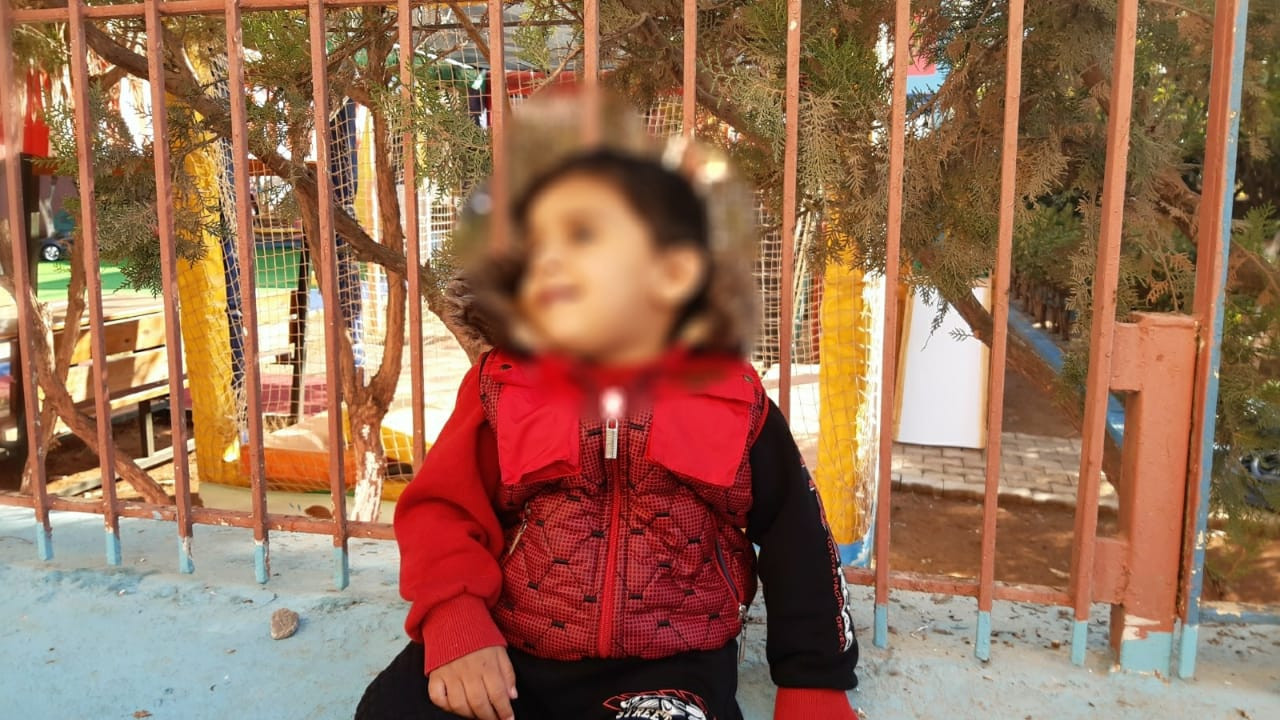 A little child needs hearing aids