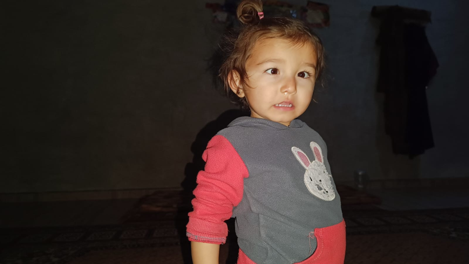 Yaqeen is a child who needs eye surgery!